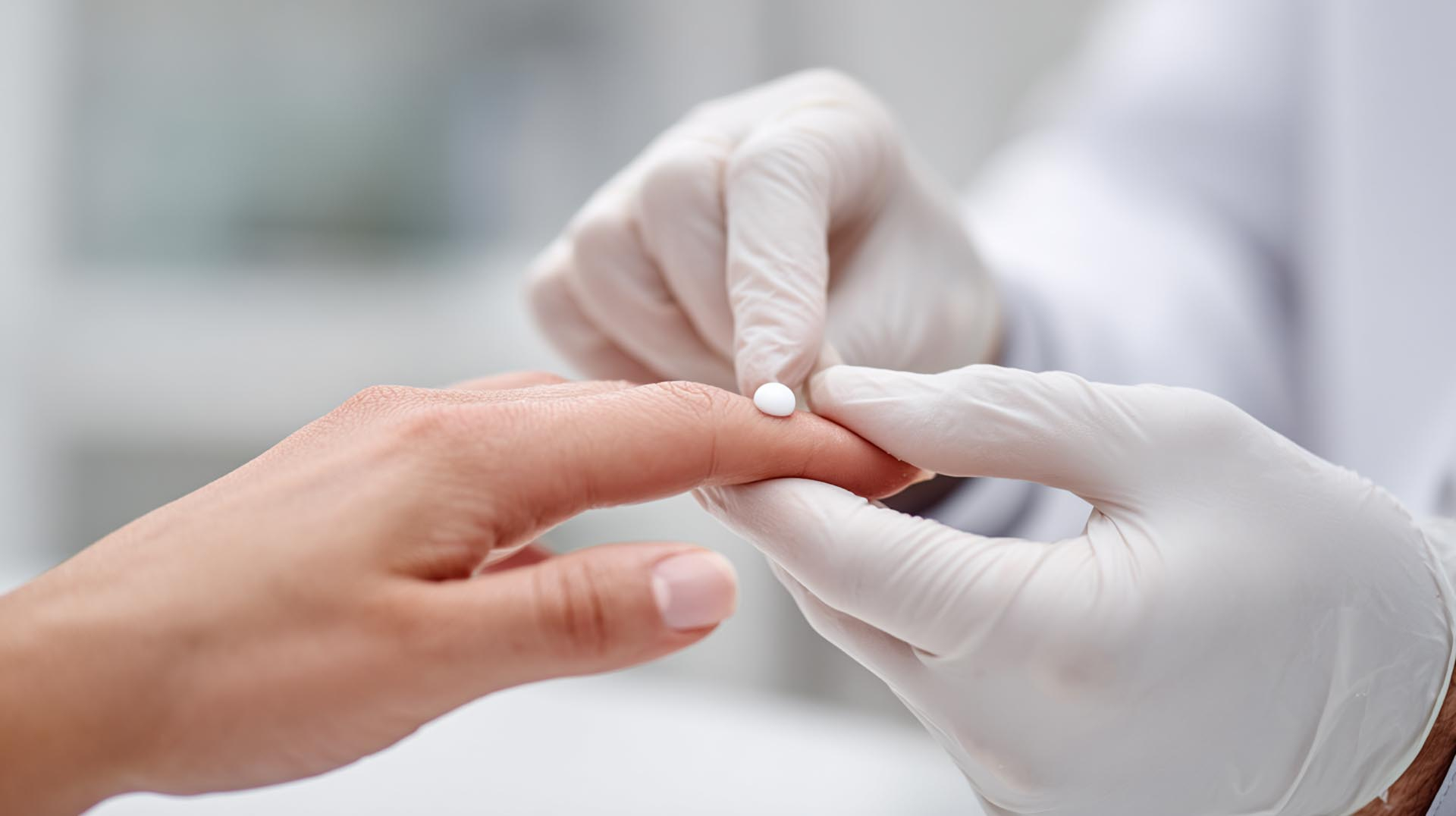 A provider demonstrates the correct amount of topical retinoid cream to a patient, a key patient education topic in the Treating Acne CE Nursing course.